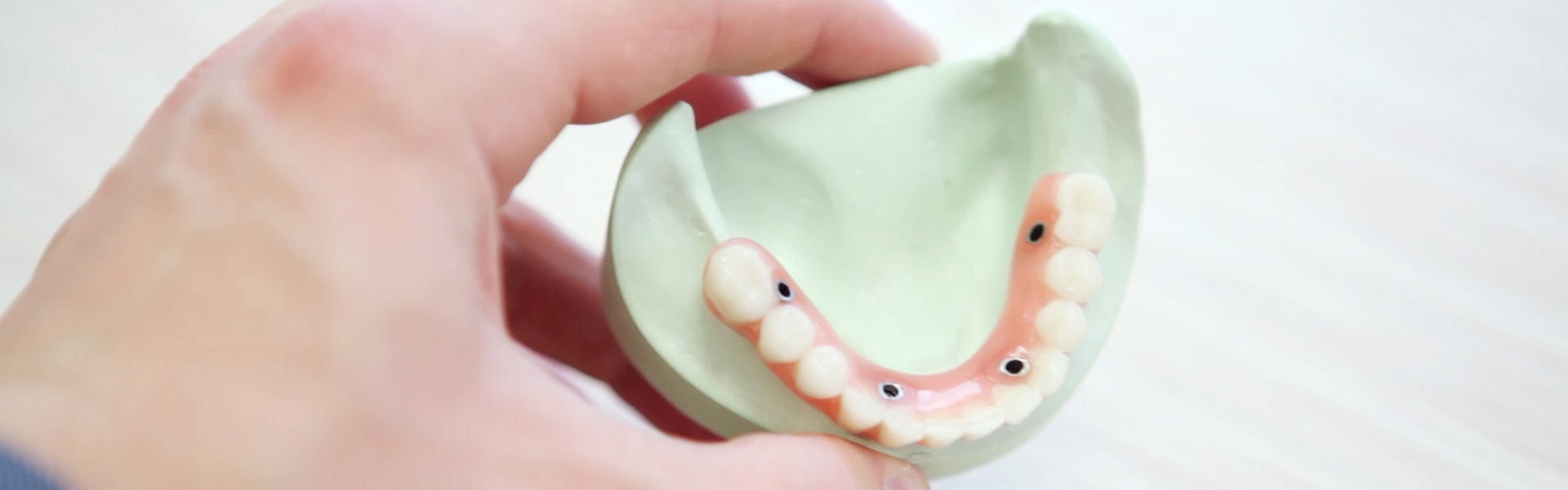 Kasko osiguranje | Zubna tehnika